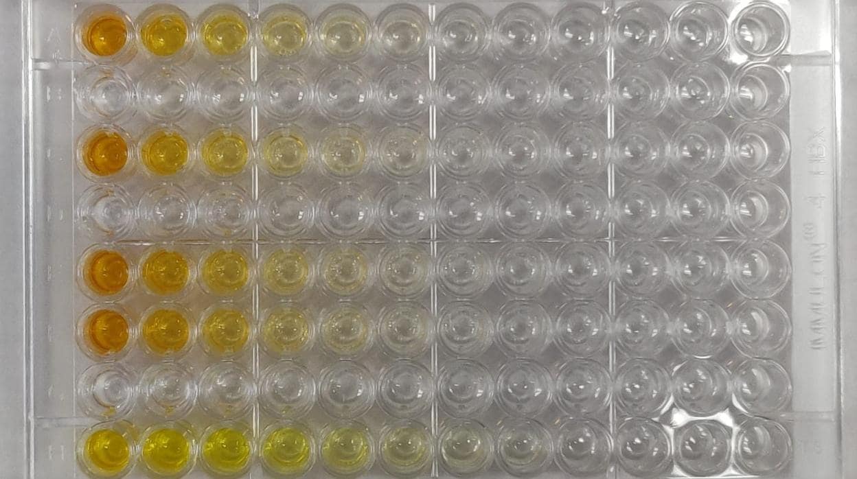 Placa de prueba ELISA que muestra anticuerpos. Cuanto más oscuro es el color amarillo, más anticuerpos están presentes. Mount Sinai Health System