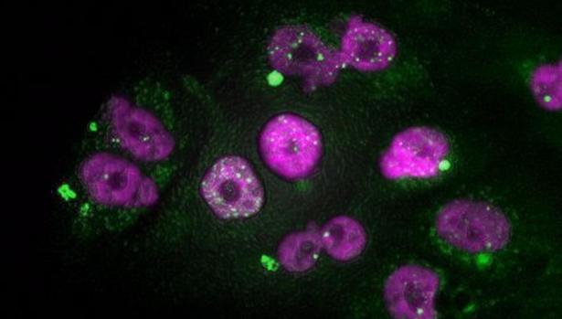 Investigadores españoles desarrollan un reloj epigenético que predice la evolución del cáncer