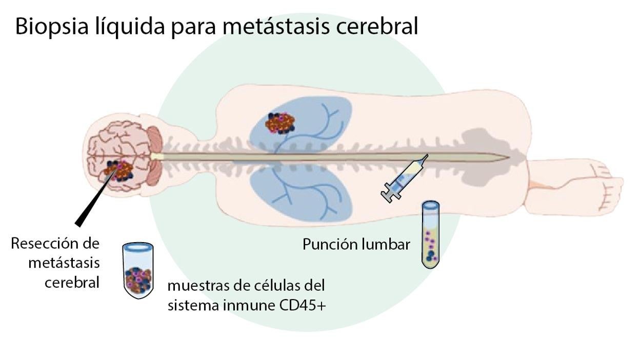 Biopsía líquida para metástasis