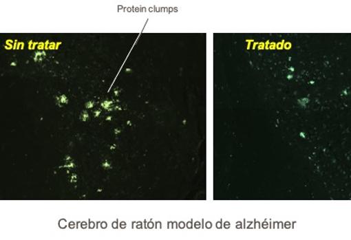 Cerebro de ratón con alzhéimer