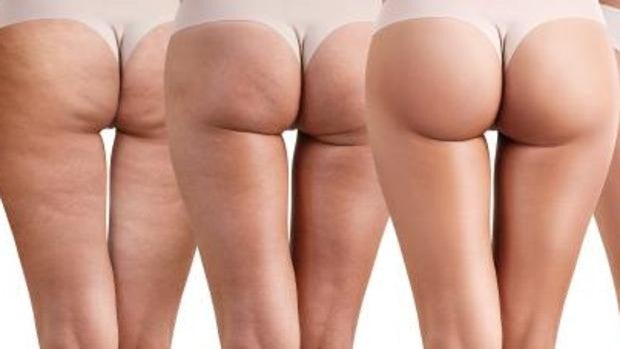Culomanía: En busca del trasero voluminoso perfecto