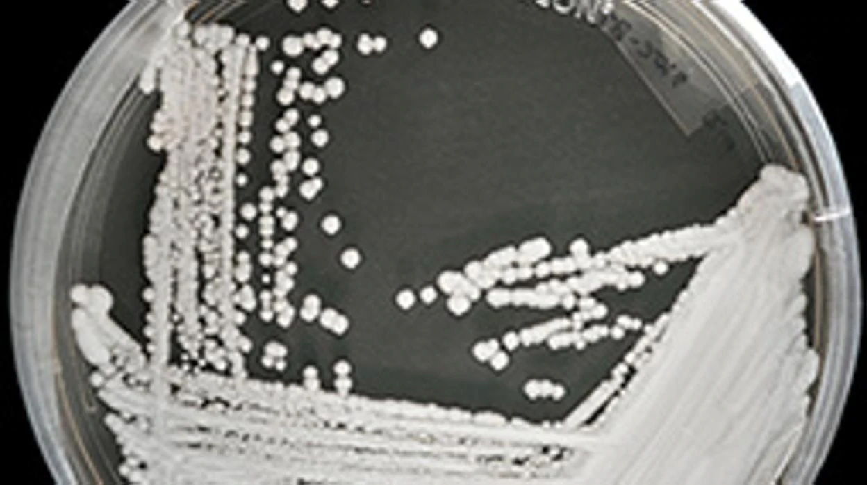Cultivo de una cepa de Candida auris en una placa de Petri en los CDC