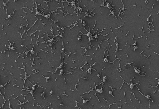 Células de Mycoplasma pneumoniae, pequeñas bacterias que están naturalmente adaptadas al pulmón humano.