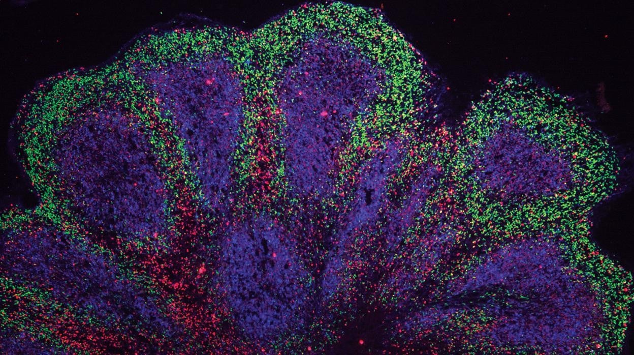 Mini-cerebro organoides que muestran estructuras similares a la corteza