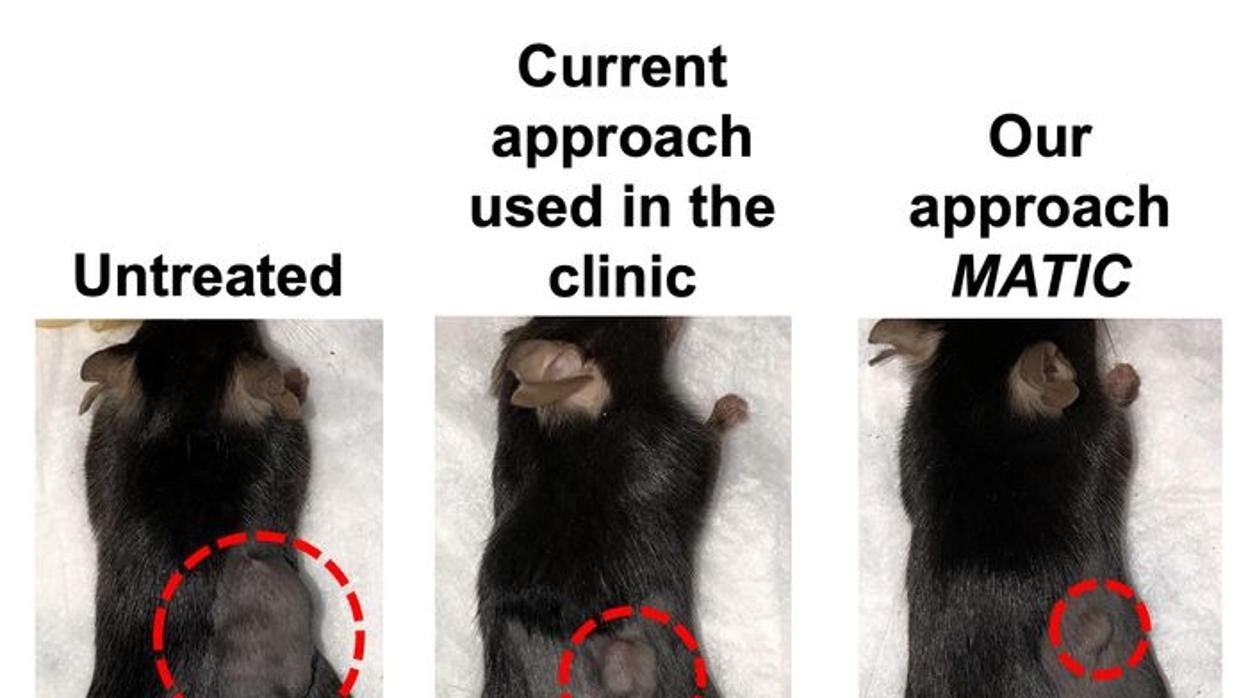 Evolución del tumor