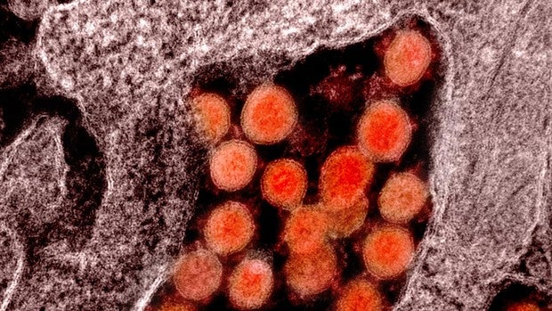 Hallan restos de coronavirus en heces humanas hasta 7 meses después de la infección