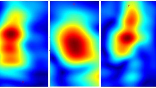 ¿Adiós a la biopsia? Un dispositivo identifica sin dolor los cánceres de piel