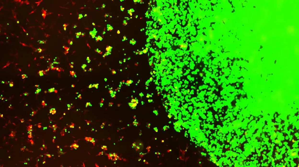 Células madre encapsuladas (verde) siguiendo y matando células tumorales de gbm (rojo)