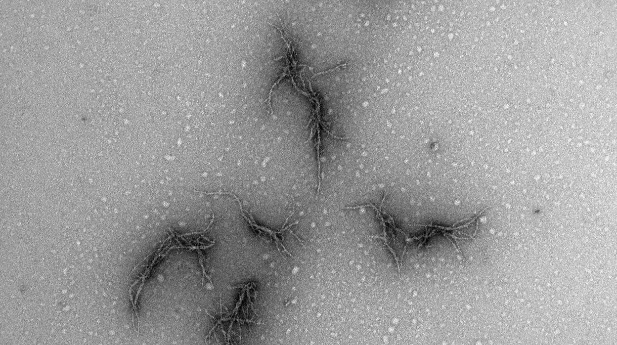 Imagen del amiloide de la proteína de la espiga del virus SARS-CoV-2, vista con un microscopio electrónico. Cuando la proteína de espiga se mezcla con la enzima elastasa de neutrófilos en tubos de ensayo, se crean fibrillas proteicas ramificadas, que potencialmente pueden causar alteraciones de la coagulación sanguínea en pacientes con Covid-19