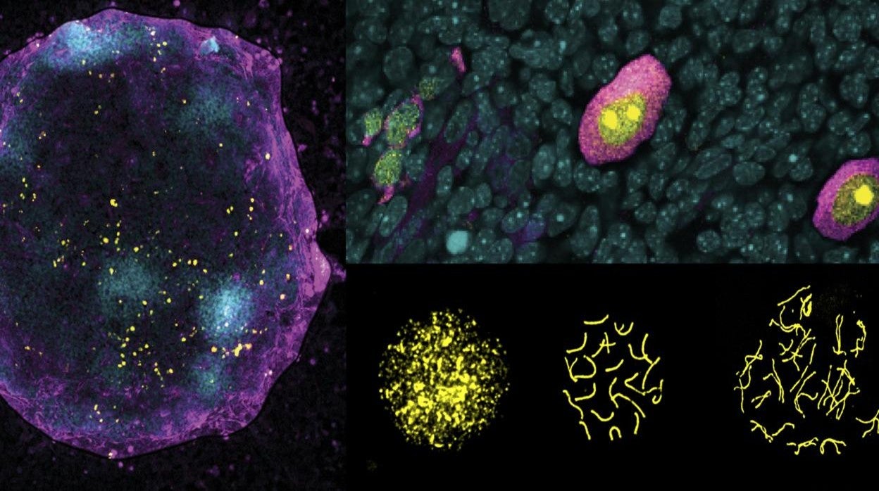 (izquierda) Imagen de un ovario artificial, donde las células germinales femeninas generadas in vitro (magenta) entran en meiosis (células amarillas) para convertirse en ovocitos gracias a las células de apoyo (cian). Este proceso es 4 veces más eficiente cuando el cromosoma X se apaga y se enciende correctamente durante el desarrollo de las células germinales. El panel superior derecho muestra ovocitos en diferentes etapas de maduración: los más inmaduros a la izquierda y los más avanzados a la derecha. El panel inferior derecho muestra la organización cromosómica durante el proceso de meiosis cuando las células germinales se vuelven únicas al reorganizar su material genético. Crédito: