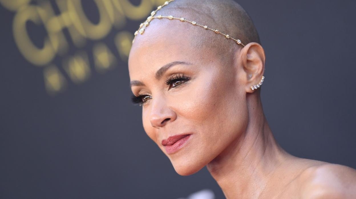 Jada Pinkett compartió este año que tiene alopecia areata