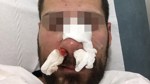 Un policía antidisturbios de Sevilla recibe una brutal paliza en Melilla por un grupo de jóvenes