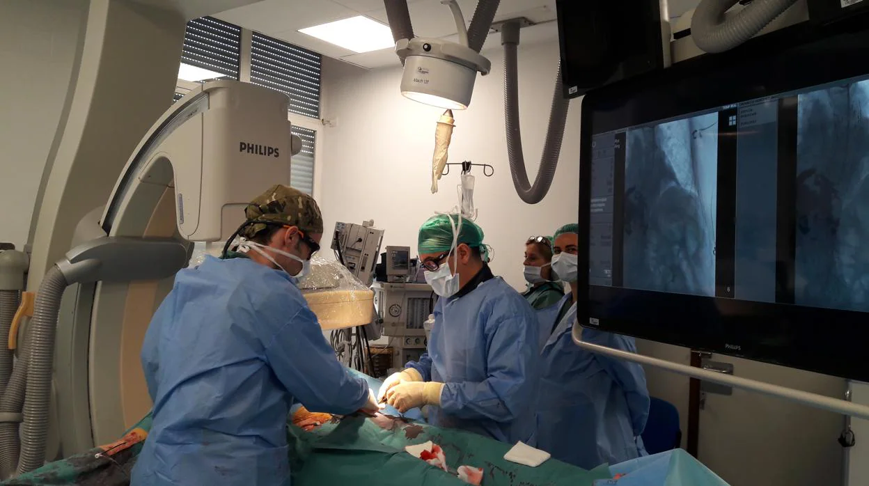 Radiólogos operando a un paciente con un aneurisma en la arteria aorta mediante una punción en las ingles y sin necesidad de realizar ninguna incisión en la piel