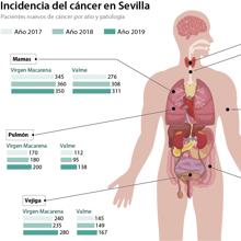 Las seis noticias que debes conocer hoy, lunes 20 de julio