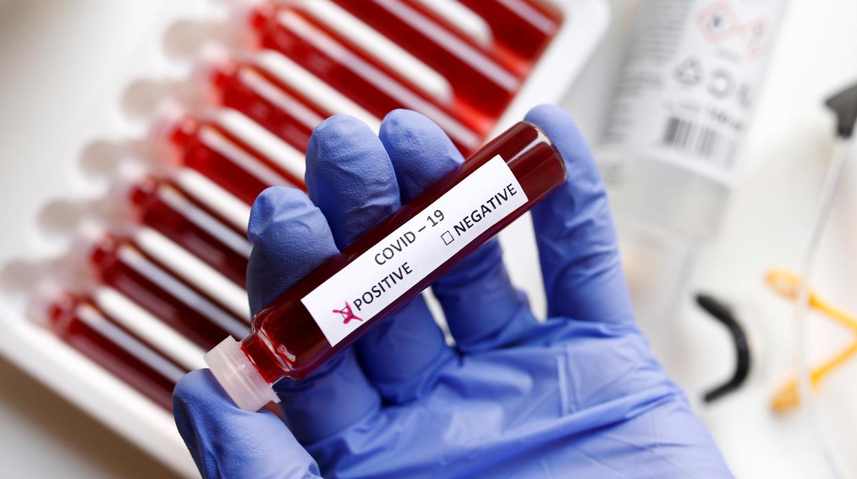 Muestra de sangre de un test serológico que ha dado positivo en coronavirus