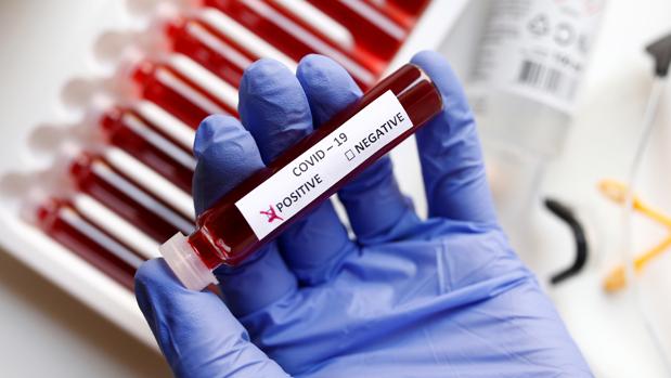 Cómo, dónde y cuánto cuestan los tres tipos de test para detectar el coronavirus