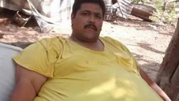 Muere el hombre más obeso del mundo