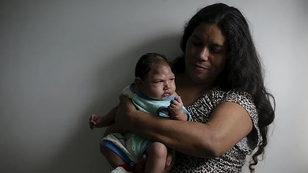 Una madre brasileña sostiene a su bebé, con microcefalia