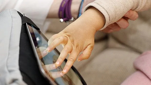 Ciertos movimientos de la mano que son típicos del síndrome de Rett