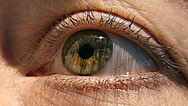 Una persona afectada por glaucoma