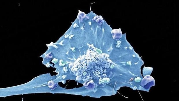 Un estudio identifica los genes y mutaciones que causan el cáncer de pecho