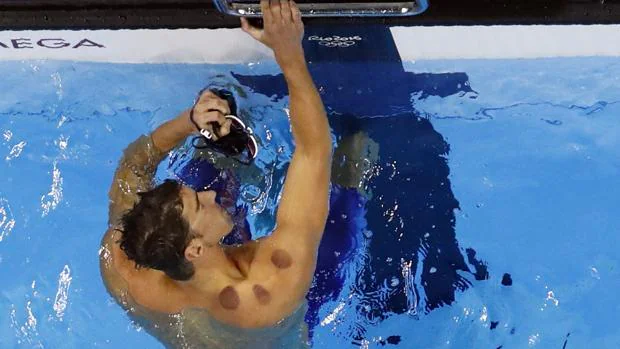 La terapia milenaria que usa Michael Phelps para triunfar en los Juegos Olímpicos