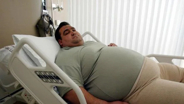 Un hombre obeso a la espera de una operación de estómago