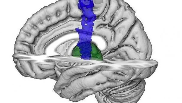 Imagen de cerebro que muestra la ubicación del tálamo (verde) y corteza motora primaria (azul)