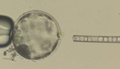 Inyección de células humanas en en el interior de un embrión de cerdo