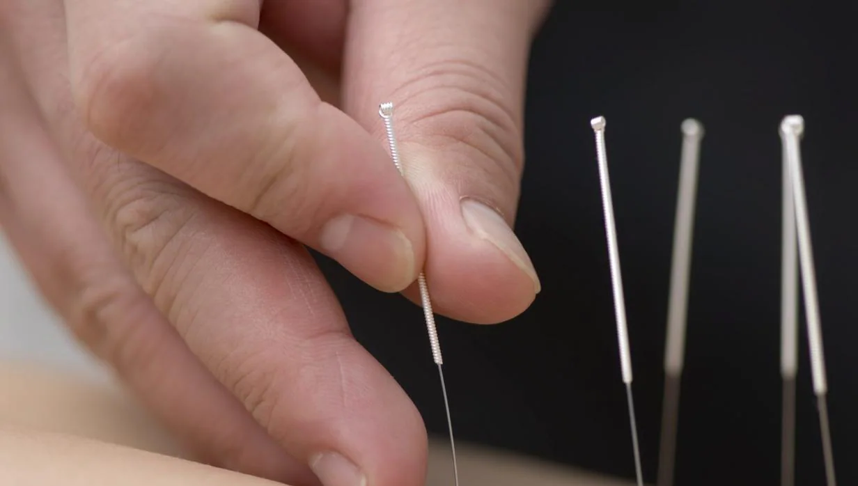 La acupuntura podría ser más eficaz que los tratamientos farmacológicos