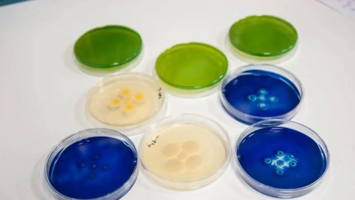 Placas Petri que albergan cepas de la superbacteria S. Aureus, una de las más letales