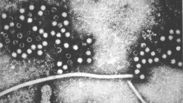 Asciende a 38 el número de personas afectadas por un brote de hepatitis A en un restaurante de Palma