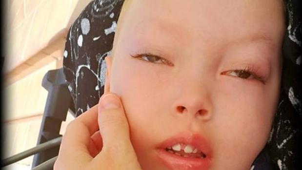 Fallece el pequeño Liam, el niño tinerfeño con Tay-Sachs