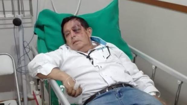 Un hombre de 62 años, a punto de perder el ojo izquierdo tras una brutal paliza en Perú