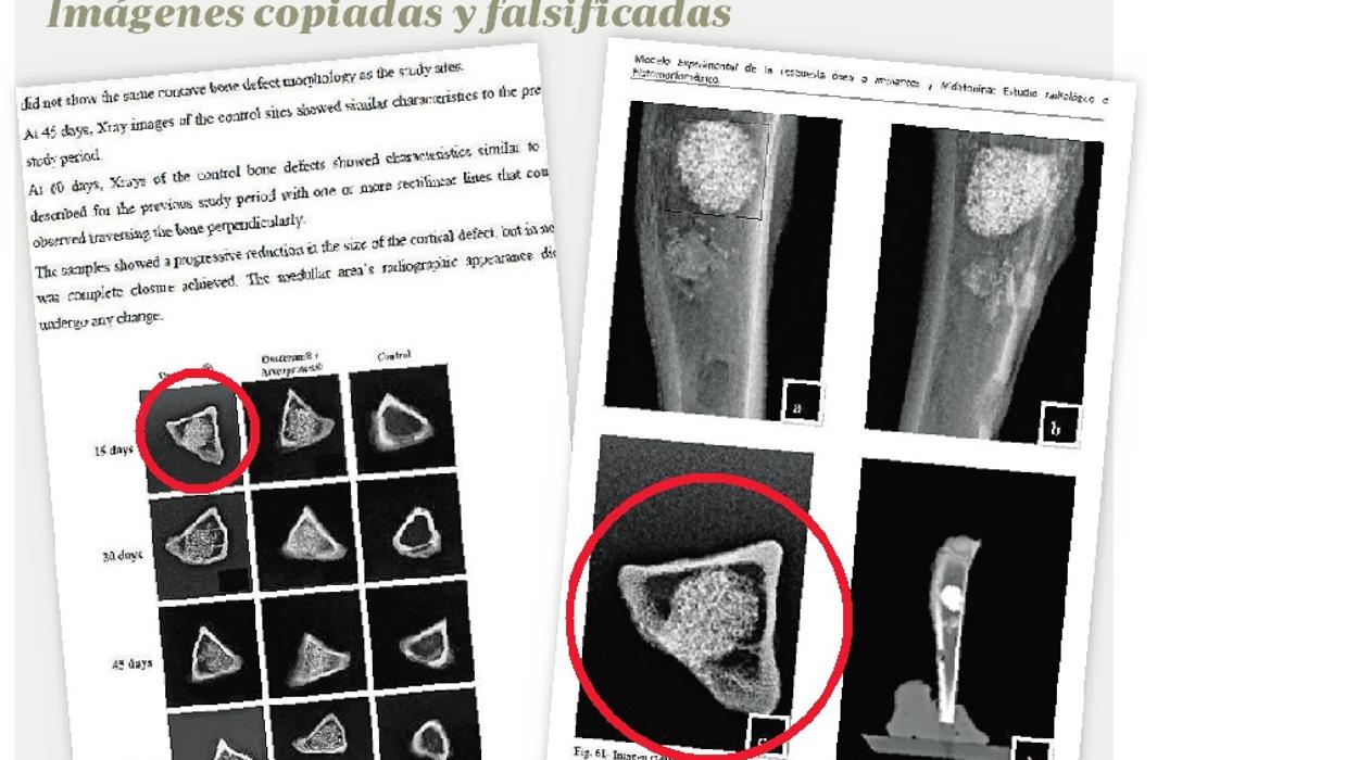 La imagen de la izqda. es la tesis de Calvo Guirado (2014), en la que aparece rodeada la foto del hueso de un conejo sacrificado, dice, 15 días después de haberle colocado un implante de «endobone». La imagen de la derecha es la tesis de su alumna Piedad Ramírez, leída 5 años antes, en 2009. La foto del hueso es exactamente la misma, pero en este caso el implante no era «endobone», sino «ossceram», y la foto y el sacrificio del animal se produjeron a los 30 días de la cirugía, no a los 15.