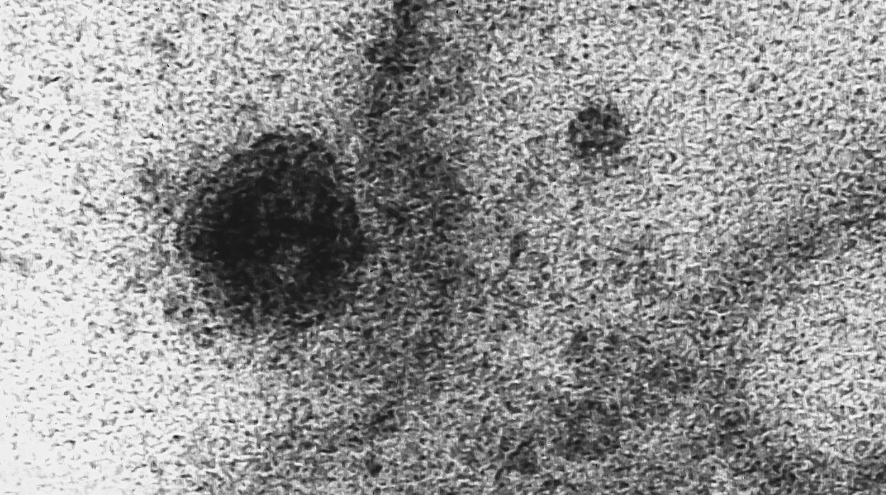 Un laboratorio de Brasil capta imágenes del momento exacto en que el coronavirus infecta una célula