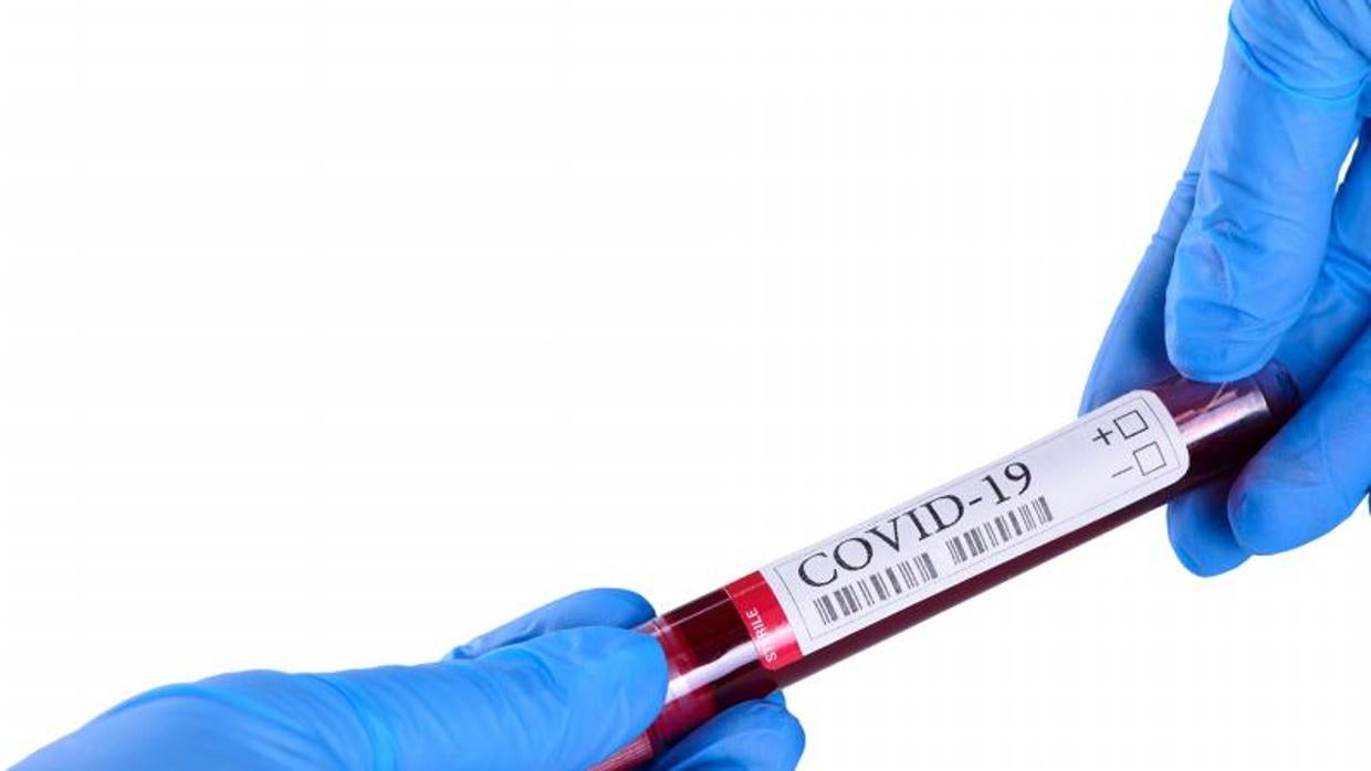 El CSIC crea un nuevo test de coronavirus con más del 98% de fiabilidad