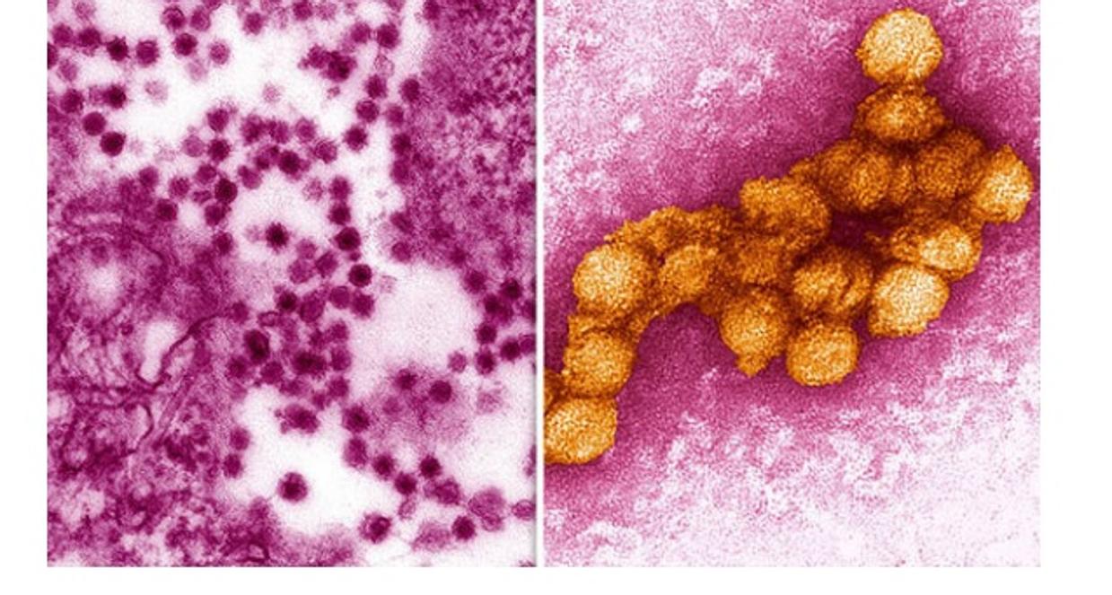 De cuando caían «cuervos muertos» en Nueva York en 1999 y era «el virus del Nilo occidental»