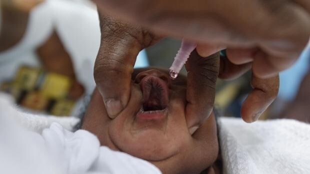 África confirma el primer caso de poliomielitis en cinco años