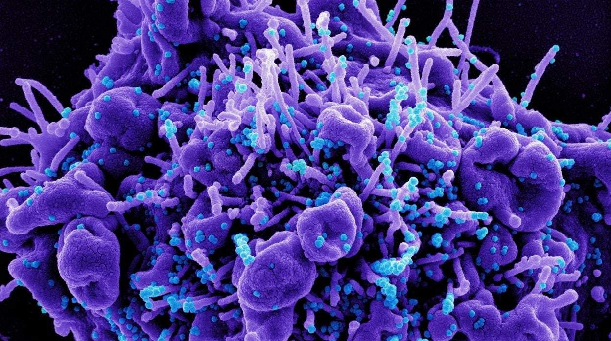 Micrografía electrónica de barrido coloreada de una célula apoptótica (púrpura) infectada con partículas del virus SARS-COV-2 (azul)