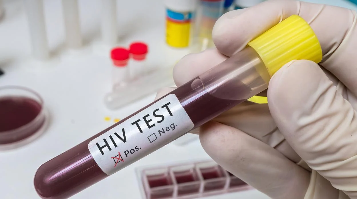 Test de VIH positivo
