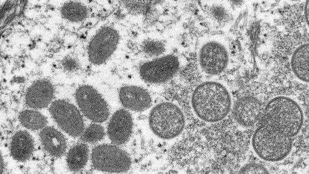 Portugal es el primer país que secuencia el genoma delvirus de la viruela del mono