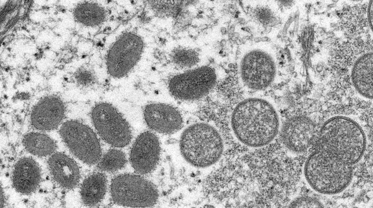 Una imagen microscópica electrónica (EM) muestra partículas maduras del virus de la viruela del mono