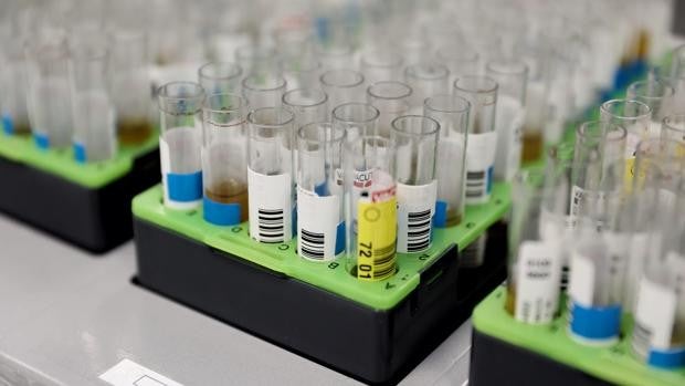 Sanidad confirma 156 casos de viruela del mono, 14 más que el miércoles