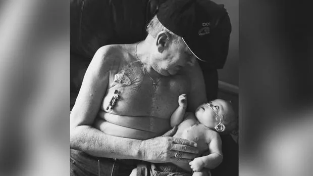 Abuelo y nieto comparten cicatriz en el centro del torso