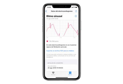 Cómo realizar un electrocardiograma con el Apple Watch